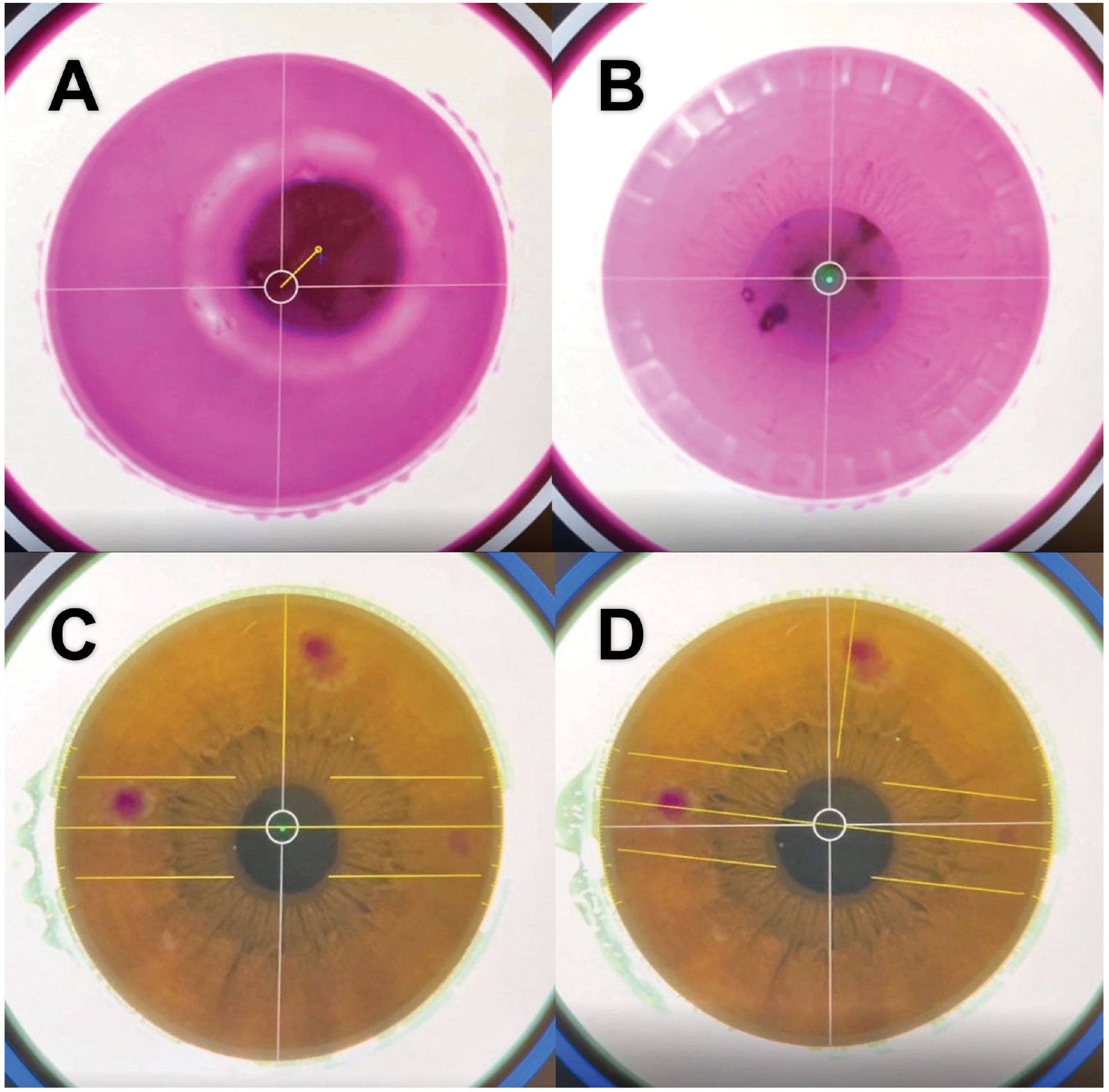 eye-diagram
