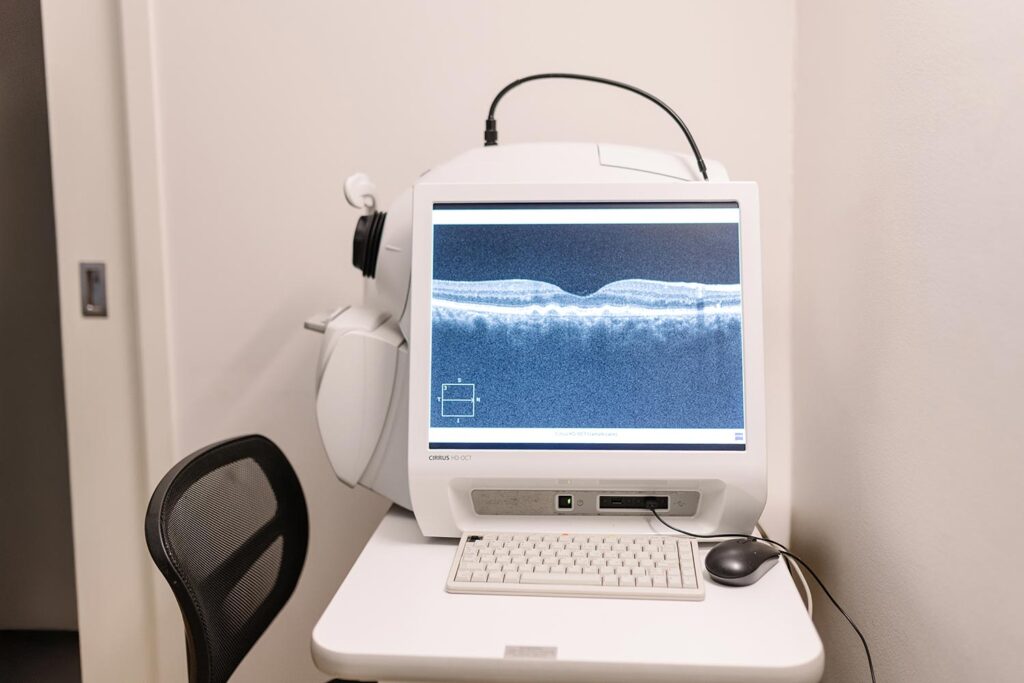 Optical coherence tomography (OCT) scanner on a desk with a monitor displaying a retinal cross-section image, in a clinic room.
