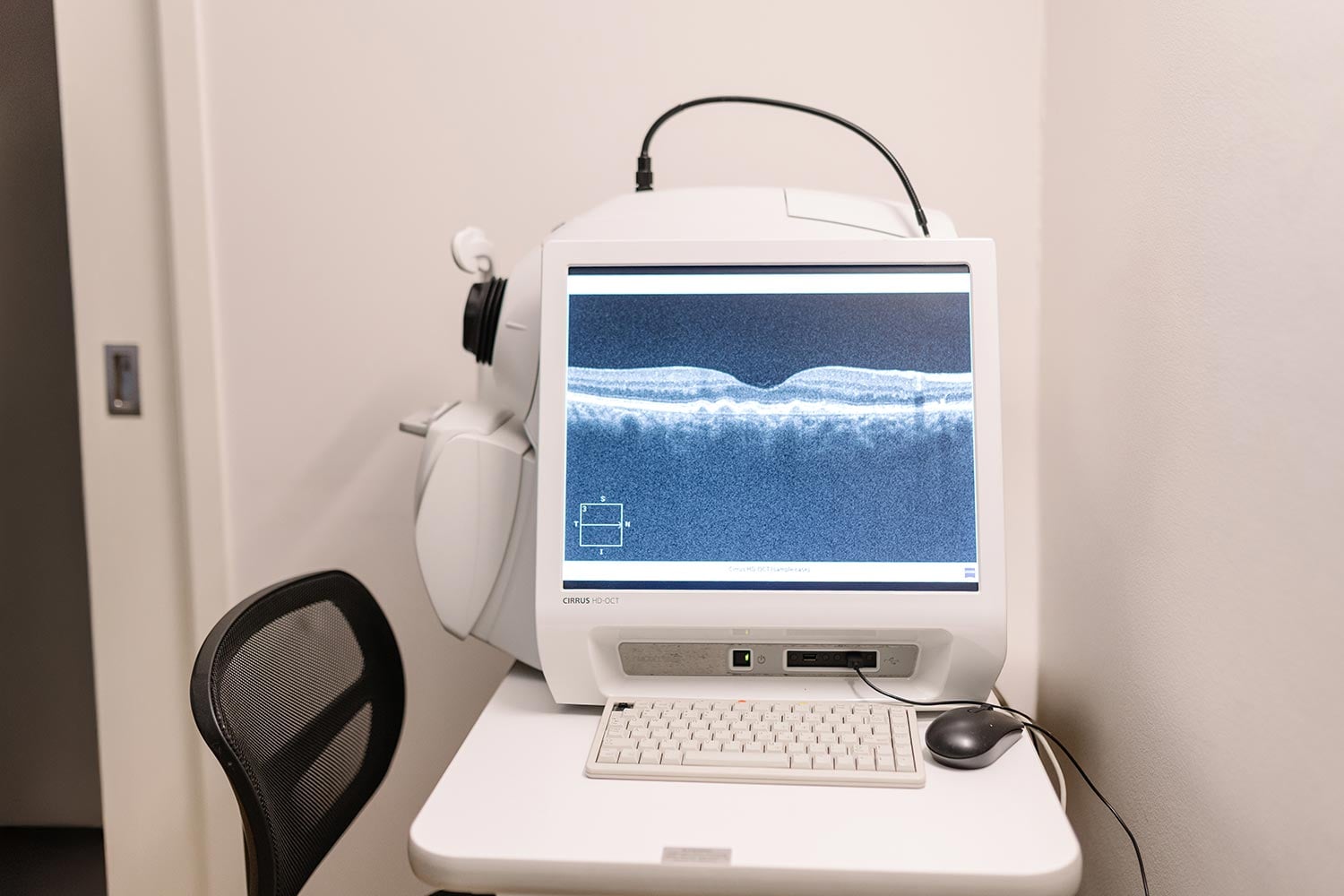 Octos Eye Scanner Technology