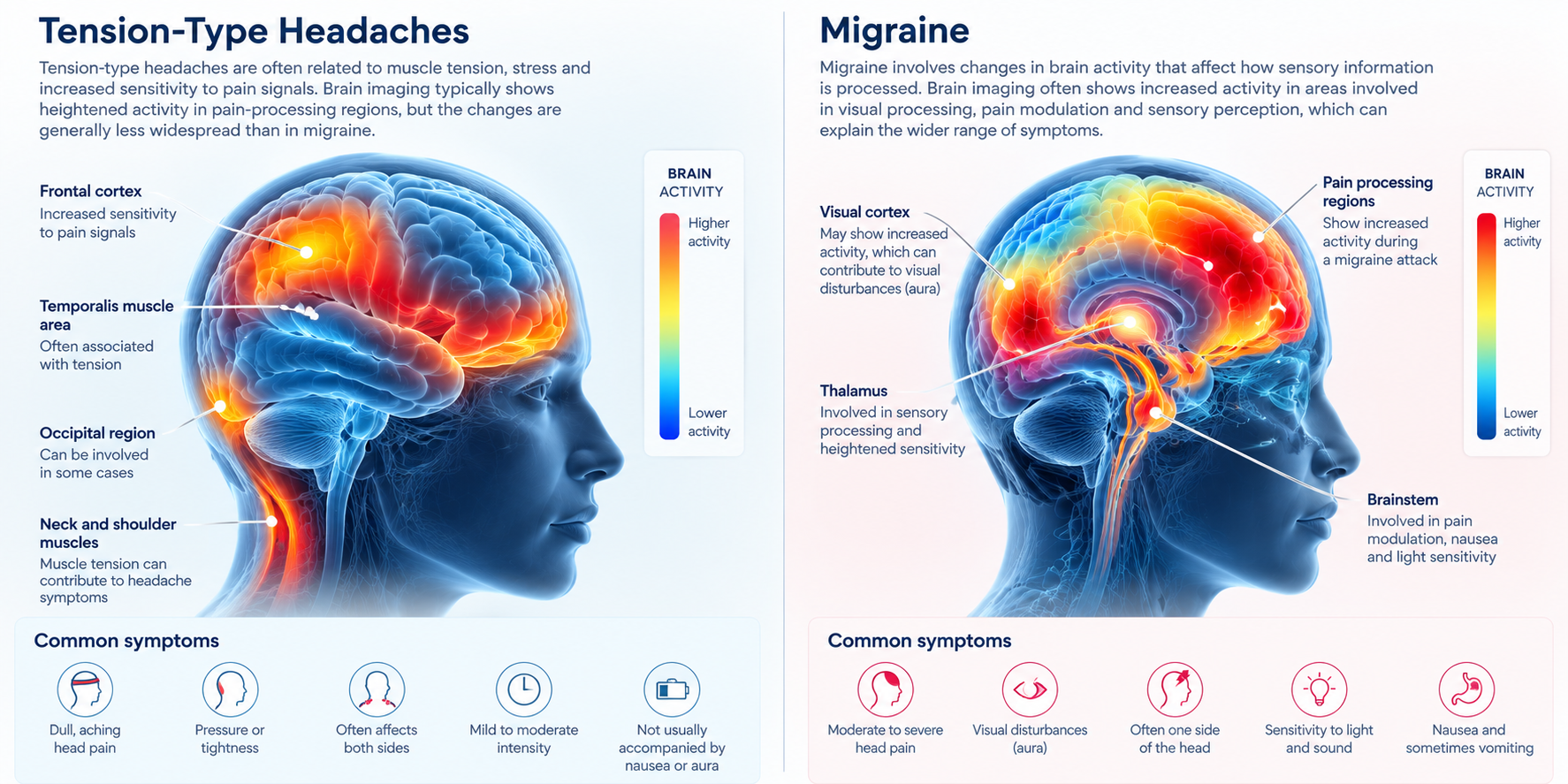 Tension Headaches vs Migraine Infographic